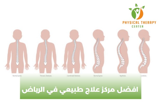 افضل مركز علاج طبيعي في الرياض