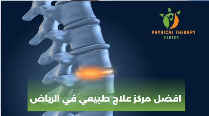 افضل مركز علاج طبيعي في الرياض