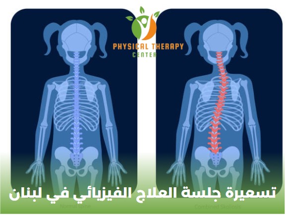 تسعيرة جلسة العلاج الفيزيائي في لبنان