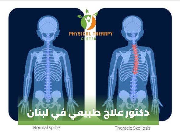 دكتور علاج طبيعي في لبنان