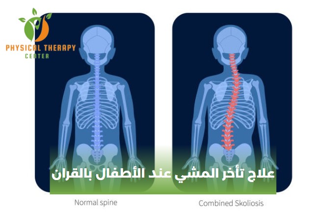 علاج تأخر المشي عند الأطفال بالقران