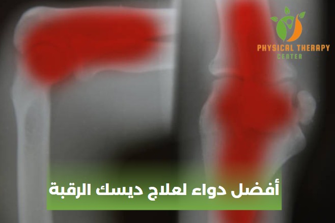 علاج الديسك الرقبي بدون جراحة