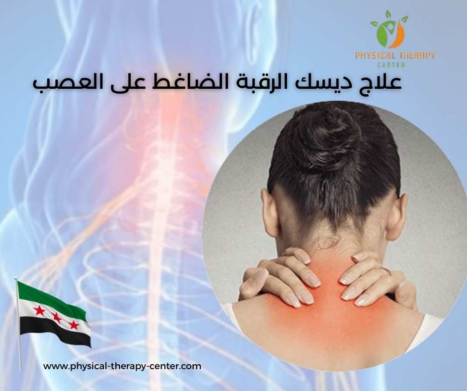 علاج ديسك الرقبة الضاغط على العصب