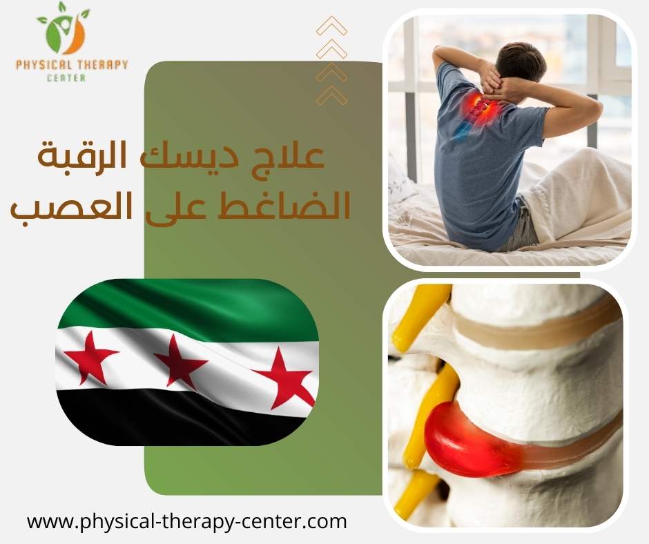 علاج ديسك الرقبة الضاغط على العصب