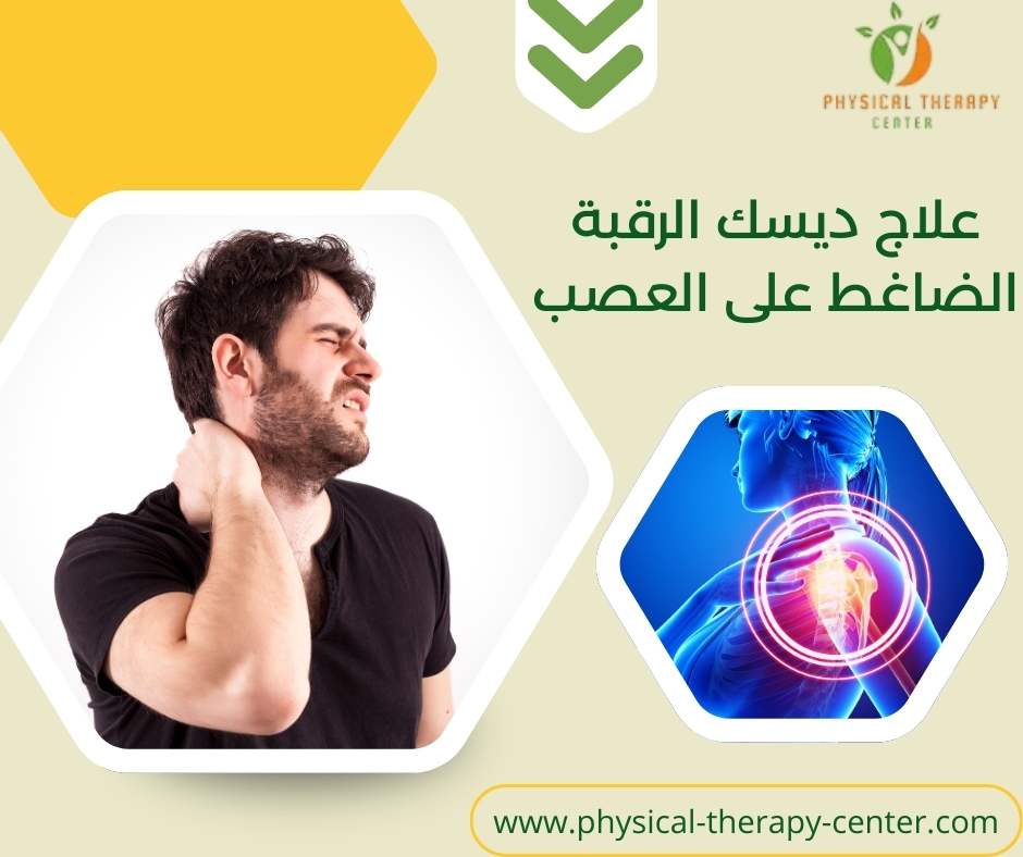 علاج ديسك الرقبة الضاغط على العصب