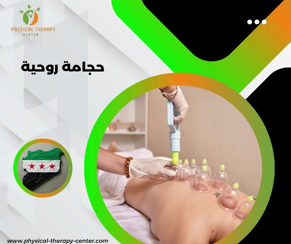 حجامة في سوريا