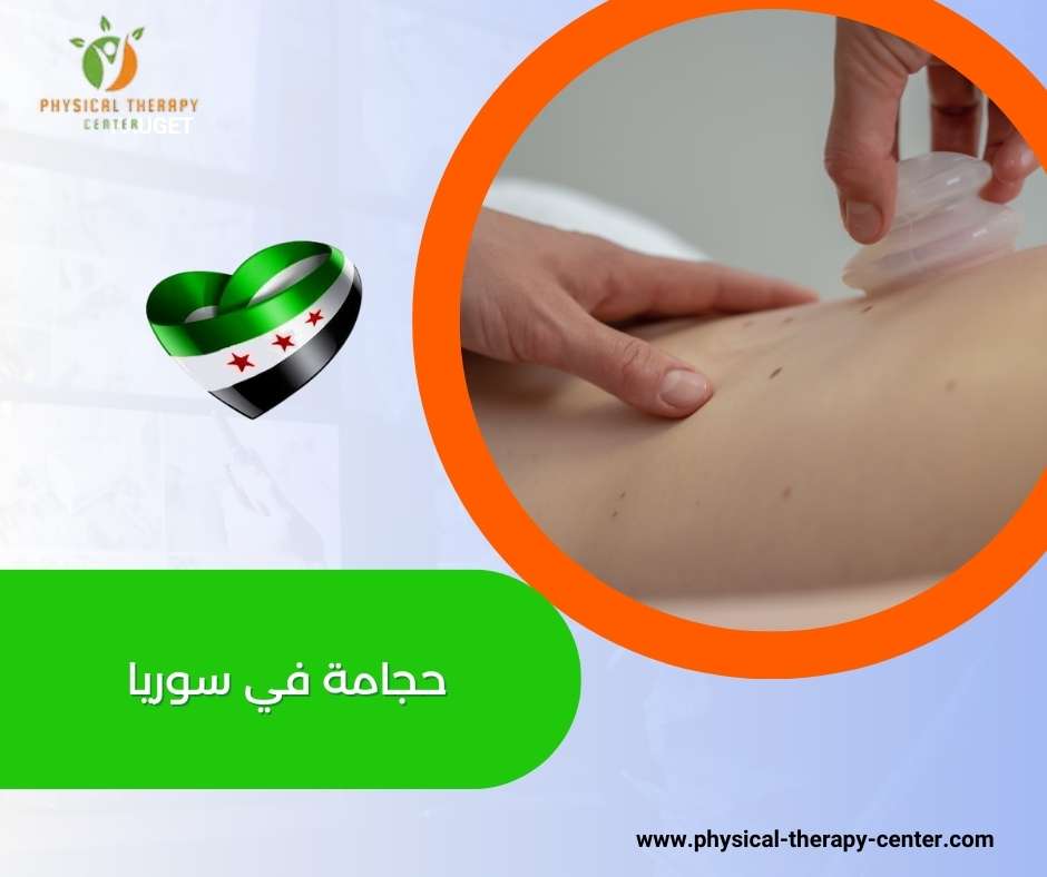 حجامة في سوريا